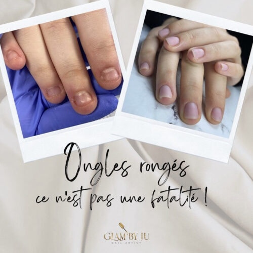 reconstruction-ongles-ronges-baillargues