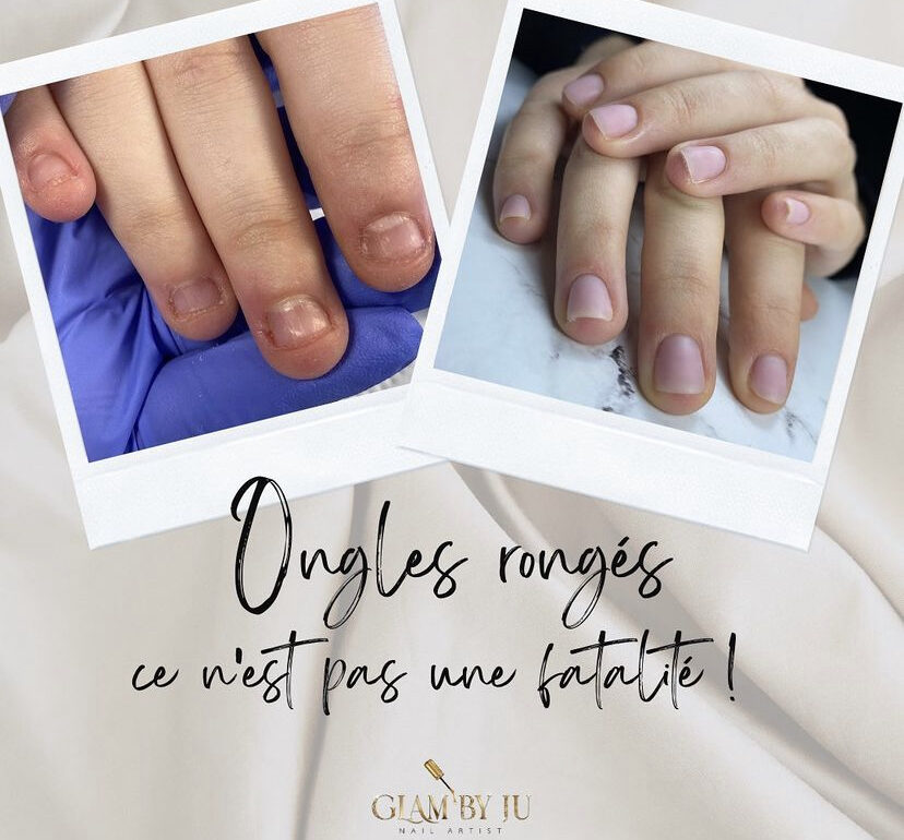 reconstruction-ongles-ronges-baillargues