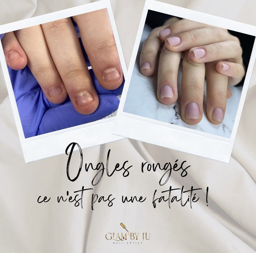 reconstruction-ongles-ronges-baillargues